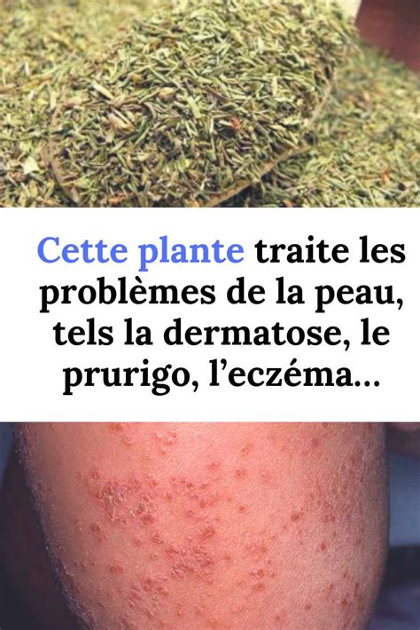 Cette Plante Traite Les Probl Mes De La Peau Tels La Dermatose Le 46800 Hot Sex Picture