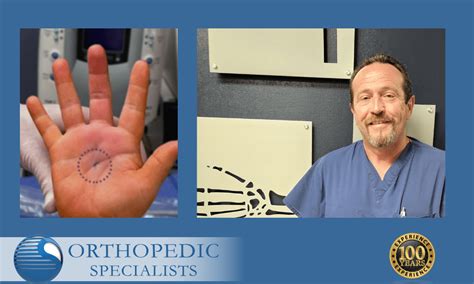 Now Offering In Office Trigger Finger Release Orthopedic Specialists