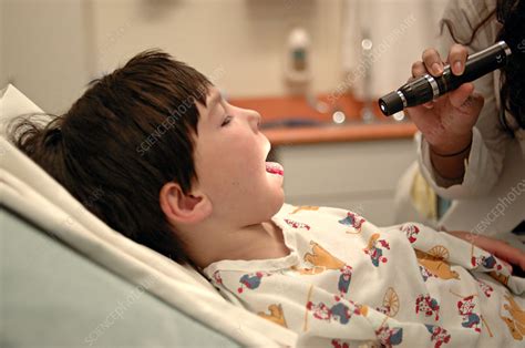 Boy Having Tonsils Examined Stock Image M8251049 Science Photo