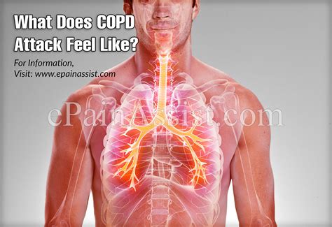 What Does Copd Attack Feel Like
