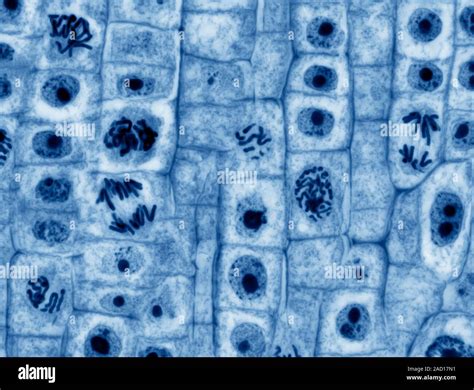 Mitosis Light Micrograph Of Onion Allium Cepa Root Tip Cells