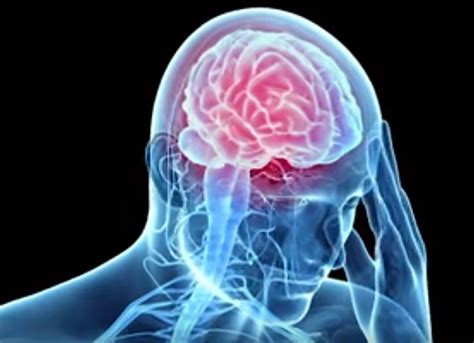 1 preventing football related brain injuries. New Findings on Brain Structure Open Door to Better ...