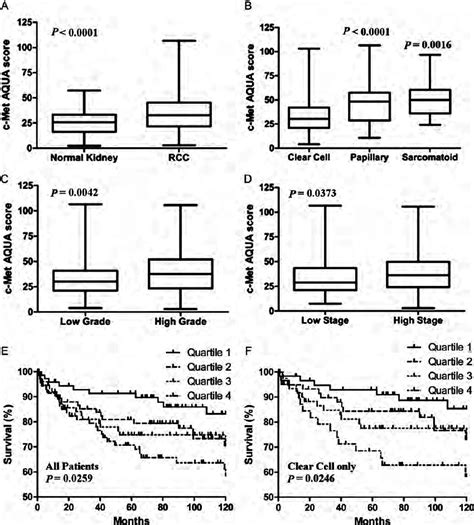 We let you watch movies online without having to register or paying, with over 10000. Box plots and Kaplan - Meier survival curves of c-Met ...