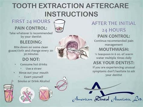 Tooth Extraction Aftercare Instructions Tooth Decay Tooth