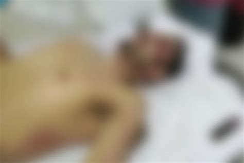 filtran las imagenes de la autopsia del chino antrax se recomienda discrecion noticias