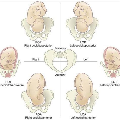 Position Of Fetus Medizzy