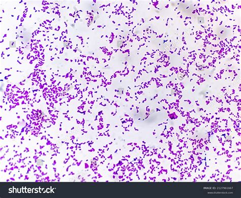 Microscopic View Gram Stain Showing Escherichia Stock Photo 2127961667