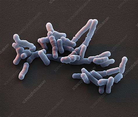Bifidobacterium Bacteria Sem Stock Image C0290325 Science Photo