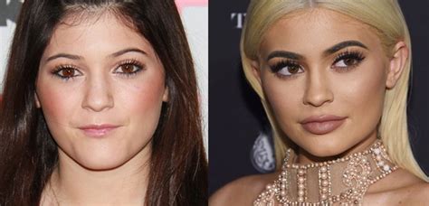 Kylie Jenner Finally Reveals The Truth Behind Her Huge Body Transformation Capital Xtra