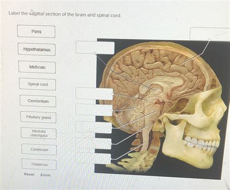 [Solved] Label the sagittal section of the brain and spinal cord. Pons