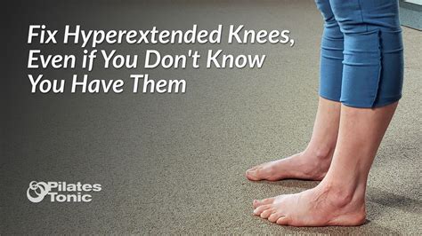 Fix Hyperextended Knees Even If You Don T Know You Have Them