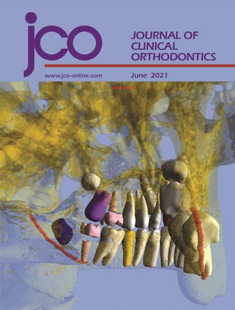 Jco Online Journal Of Clinical Orthodontics