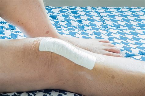 Las 4 Fases Principales De La Cicatrización De Heridas Shield Healthcare