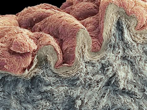 Skin Sem Stock Image P7100467 Science Photo Library