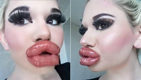 With the resurgence of the rock ballad… Woman with 'world's biggest lips' says she's not done with ...