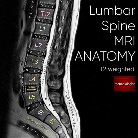 Learn about the superficial, intermediate and deep muscles of the back. The Radiologist on Instagram: "Sagittal T2 weighted image of an MRI of the lumbar spine ...