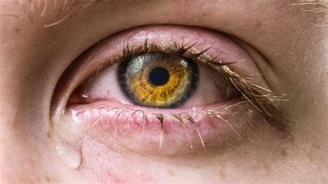 Occhio Secco Cause E Sintomi Sindrome Occhio Secco