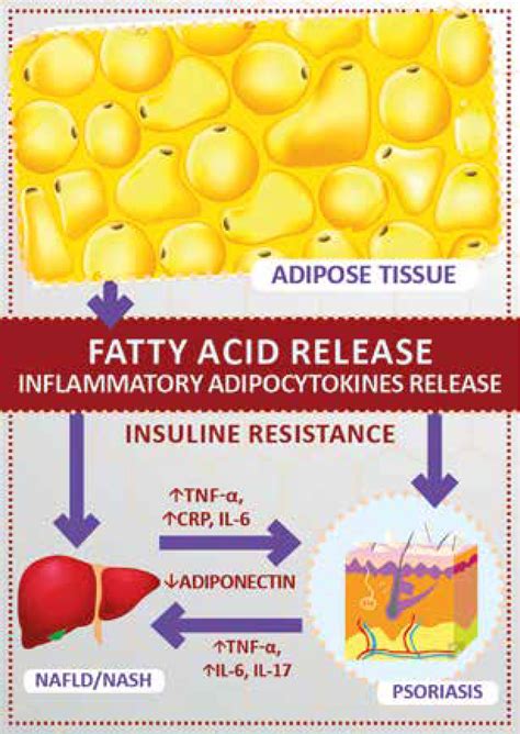 Non Alcoholic Fatty Liver Disease In Patients With Psoriasis