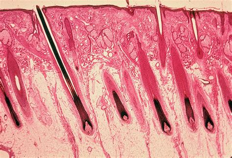 Scalp Hair Follicles Histology Slides Hair Follicle Texture Art