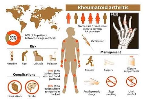 Rheumatoid Arthritis Symptoms And Treatment