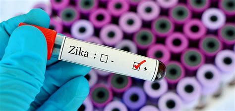 Zika Transmitted By Man With No Symptoms Natural Society