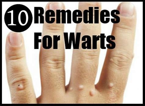 10 Effective Remedies For Warts Warts Remedy Home Remedies For Warts