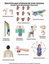 Carpal Tunnel Exercises Images