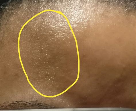 How Can I Get Skin Concern Forehead Texture Quick Surface Finish