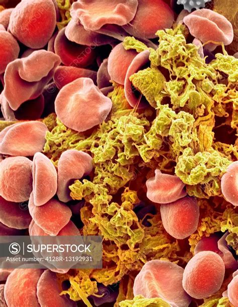 Red Blood Cells And Platelets Coloured Scanning Electon Micrograph