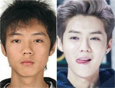 Exo Plastic Surgery Netizens Claim Exos Kai Is Suffering Side