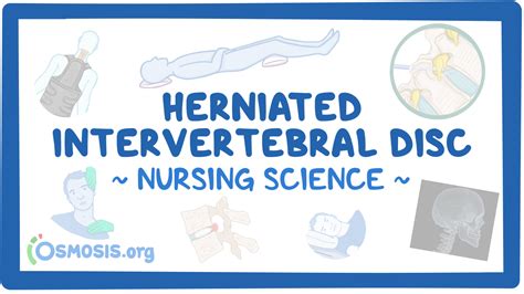 Herniated Intervertebral Disc Nursing Osmosis Video Library