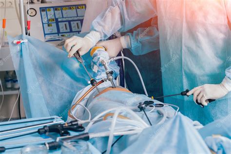proceso de operación de cirugía ginecológica utilizando equipo laparoscópico grupo de cirujanos