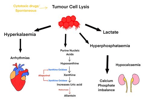 Cureus Spontaneous Tumour Lysis Syndrome In Mantle Cell Lymphoma A