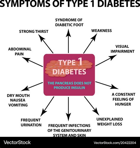 Symptoms Type 1 Diabetes Infographics Royalty Free Vector