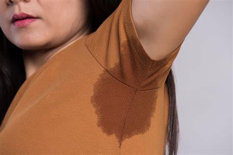 Premium Photo Close Up Asian Woman With Hyperhidrosis Sweating