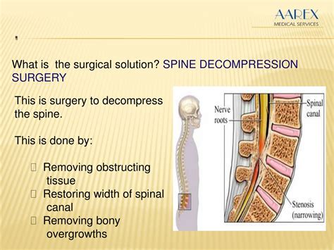 Ppt Spine Decompression Surgery Powerpoint Presentation Free