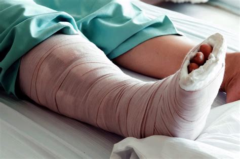 Leg Injury Claims How Much Compensation Am I Eligible To Claim