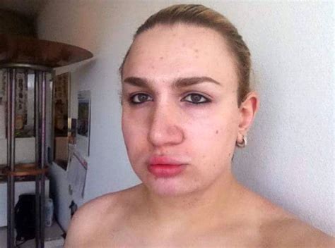 Transgender Woman Spends £110000 On Surgery To Look Like A Human Doll