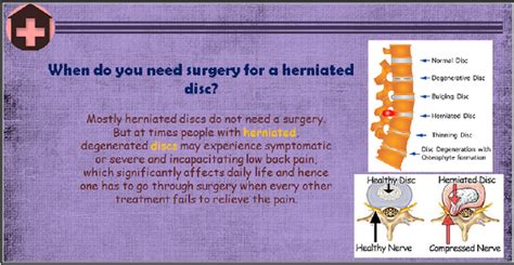 With bookimed you may get information on the herniated surgery and the final cost in the hospital as soon as possible. How much does a slipped disc surgery cost in hospitals like Fortis, Apollo, Vedanta, etc.? - Quora