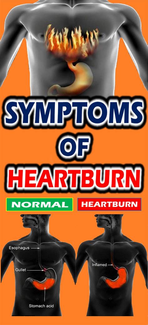Symptoms Of Heartburn Heartburn Body Health Healthy Man