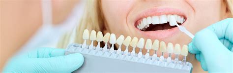 Teeth Whitening Houston Tx Jeffrey Lewis Dds P C