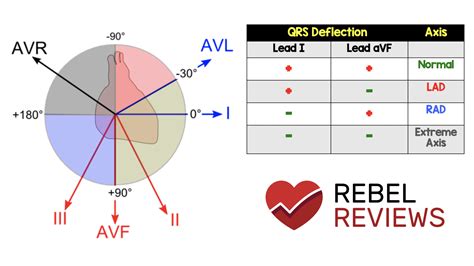 Ecg Axis Rebel Em Emergency Medicine Blog