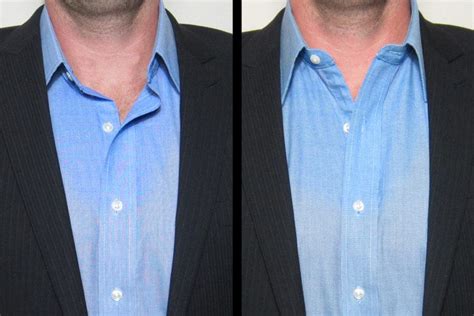 5 Tips To Perfect Looking Shirt Collars Wear Dress Shirts Without A Tie And Collar Looks Great Video