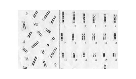 human karyotype form worksheet