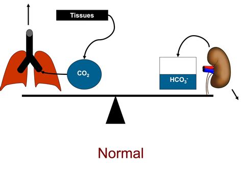 Clinical Interpretation Of Arterial Blood Gases What I Ve Learned As A Hospital Medical Director