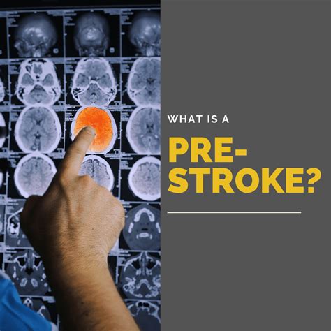 What Is A Pre Stroke Premier Neurology And Wellness Center