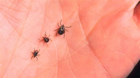 Lone Star Tick Can Cause Beef Allergy Cbs Pittsburgh Tick Bite
