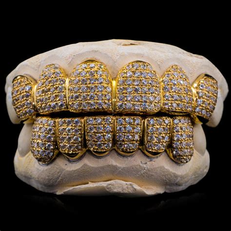 Purchase Solid Gold Fully Bustdown Iced Out Grillz Online Custom Gold