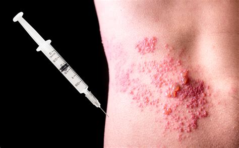 This New Shingles Vaccine Is Amazingly Effective According To Experts