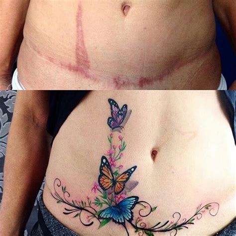 Tattoo Cicatrice Tatuaje Para Cubrir Cicatriz Tatuaje Para Tapar Cicatriz Mariposas Para